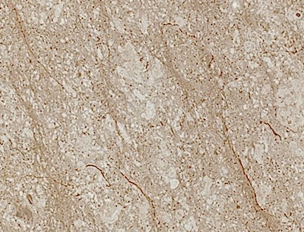 Lycia Bej Limestone